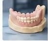Một quy trình in 3D nha khoa gồm những gì?